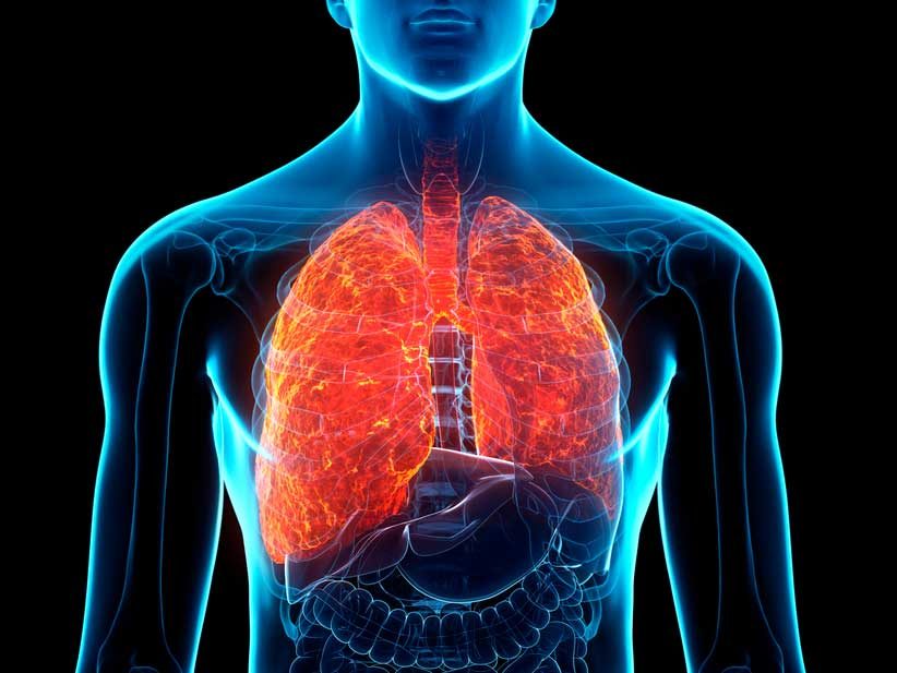 Cobertura integral de la fibrosis quística